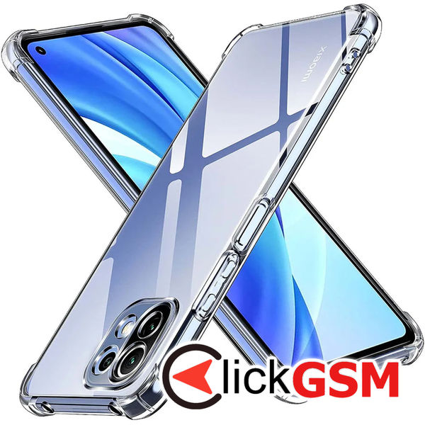 Husa Shockproof transparenta Xiaomi 11 Lite 5G NE ew